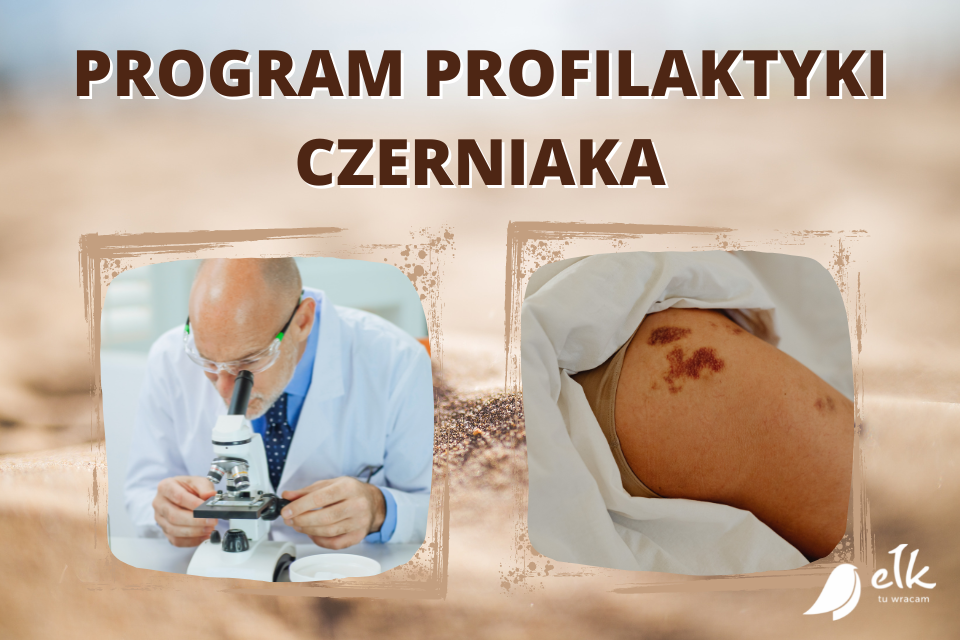 Ogólnopolski Program Profilaktyki Czerniaka
